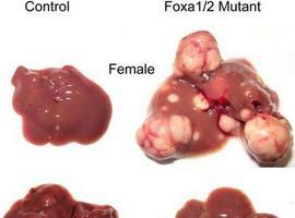 Pequeños cambios en el genoma explican las diferencias sexuales en el cáncer de hígado