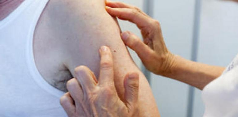 El 85% de los pacientes diagnosticados con melanoma maligno supera este tipo de cáncer de piel 