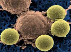 Los fármacos biológicos permiten tratamientos crónicos para evitar recaídas en linfomas y leucemias 