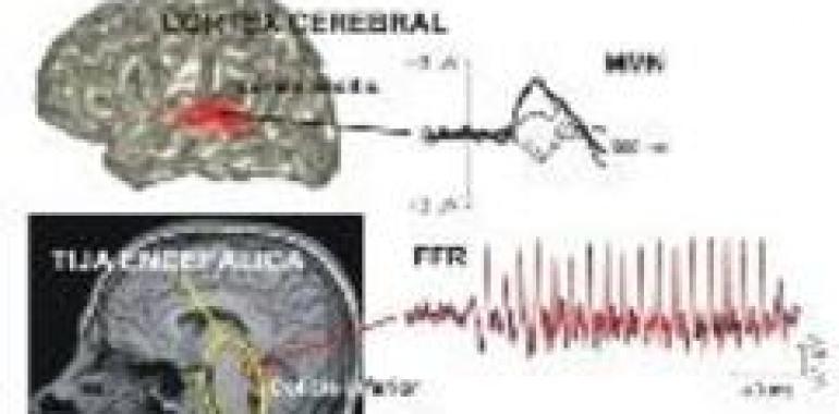 El tallo encefálico es capaz de reconocer si un sonido es familiar o no