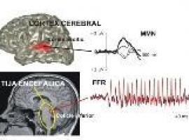 El tallo encefálico es capaz de reconocer si un sonido es familiar o no