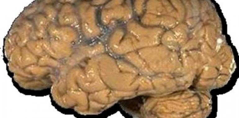 Dilemas éticos en las investigaciones sobre el cerebro