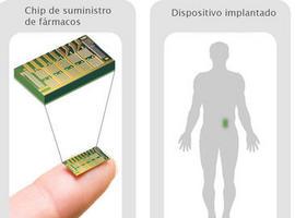 Chip implantado para dispensar fármacos contra la osteoporosis por control remoto