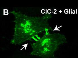 Identificadan la función de un gen involucrado en la formación de edemas en el cerebro