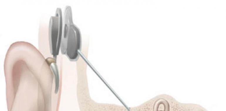 “Otorrinolaringología: La ciencia de los sentidos”, en la RANM