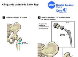 La operación de SM Don Juan Carlos incluyó una prótesis