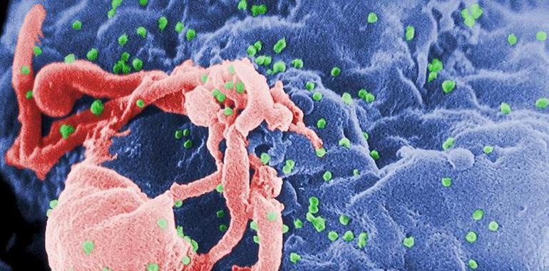 Un estudio abre la posibilidad de desarrollar una vacuna preventiva contra el VIH/SIDA