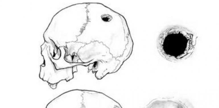 Investigadores de Oviedo y León encuentran en Soria dos cráneos trepanados de la Edad Media