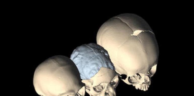 El bipedismo contribuyó al desarrollo del cerebro 