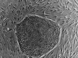 Logran convertir células de piel en células sanas de músculo cardiaco