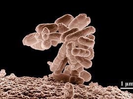 La ‘bacteria española’ es inocente