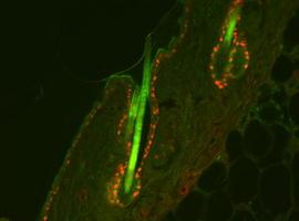 Científicos del CIEMAT utilizan nuevas tecnologías para identificar genes causantes del cáncer