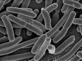 “La cepa de ‘E. Coli’ O104 nunca se ha detectado en España”