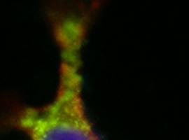 Un virus modificado genéticamente ataca de forma selectiva a las células tumorales