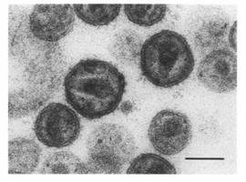 Un tercio de los españoles infectados por el VIH ignora que es portador del virus