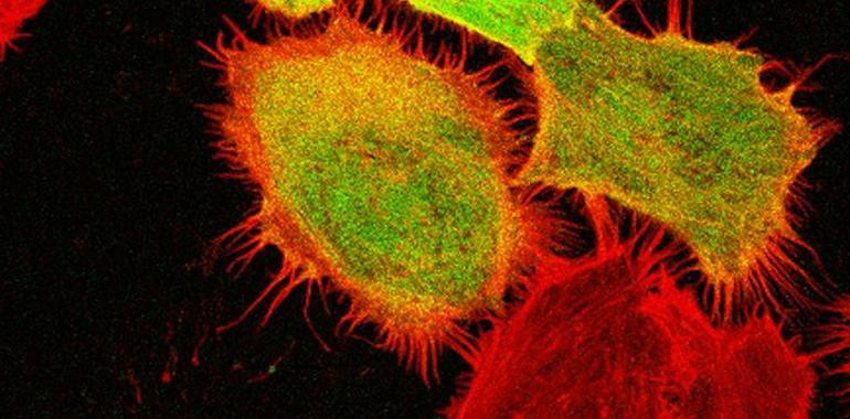 El tipo de desplazaiento celular regula la agresividad de los tumores
