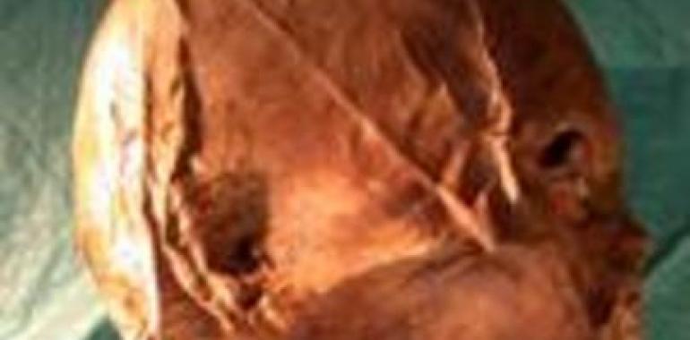 Confirman mediante prueba de ADN que la cabeza momificada de Enrique IV es auténntica