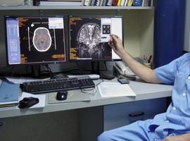 Conferencia en Gijón del doctor Fernando Seijo sobre Neuromodulación cerebral