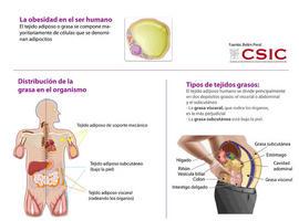 Un gen asociado a la delgadez predispone a enfermedades ligadas a la obesidad 