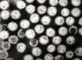 La vacuna contra el virus de la gastroenteritis aguda tiene más de un 80% de eficacia 