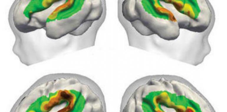 El cerebro humano puede distinguir sílabas tres meses antes de nacer