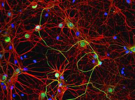Las neuronas ya tienen ‘DNI eléctrico’