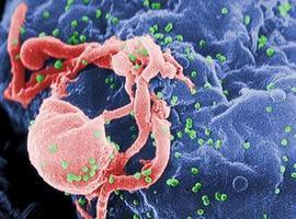 Descubren  los planes \militares\ del VIH contra un sistema inmunitario capaz de defenderse 