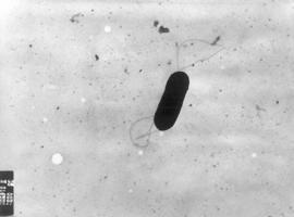 Contra la metástasis en el cáncer de páncreas