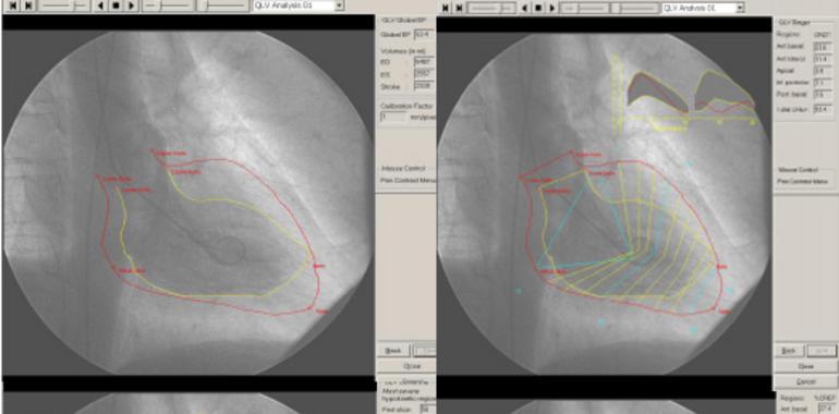 Dos trabajos del Icicor obtienen el primer premio de Diagnóstico por Imagen en Cardiología