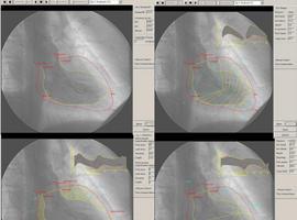 Dos trabajos del Icicor obtienen el primer premio de Diagnóstico por Imagen en Cardiología