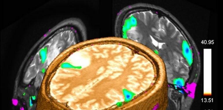 HUCA: Tecnología de diagnóstico por imagen innovadora y más segura para el paciente