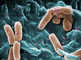 El virus del sida recluta bacterias malignas de la flora intestinal para progresar 