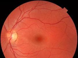 La regeneración de las neuronas de la retina ya es posible
