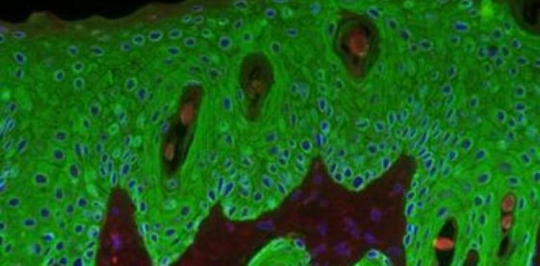 El complejo origen del cáncer