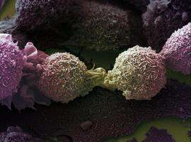 Nueva prueba predice la gravedad del cáncer