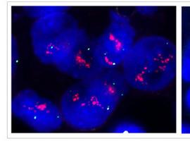 Fundación Masaveu financiará la investigación genética contra el cáncer en Asturias (IMOMA)