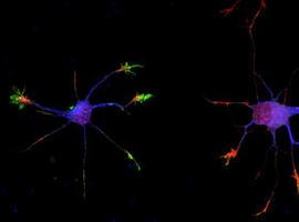 Identifican un nuevo regulador de la maduración neuronal y de la actividad sináptica