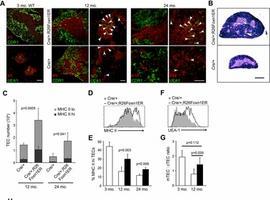 Regeneran por primera vez un órgano vivo