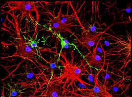 Crean un molde para nuevas piezas del puzzle neuronal