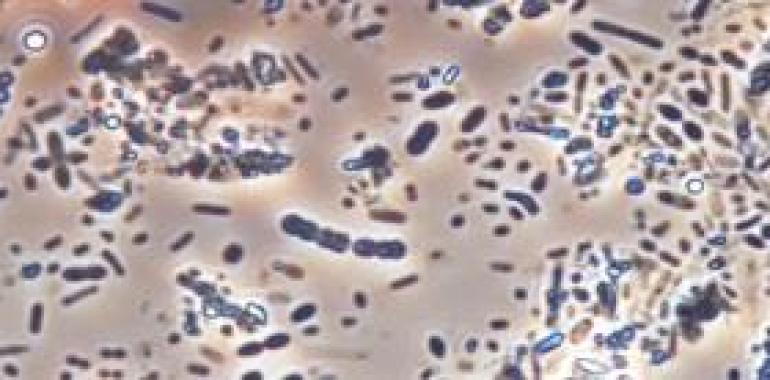 El CSIC abre nuevas vías de tratamiento para el lupus