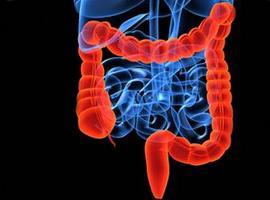 Conferencia del doctor Altadill en Gijón sobre la Enfermedad Inflamatoria Intestinal en Asturias