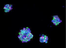 Pequeñas, pero matonas: microesferas contra el #glioblastoma