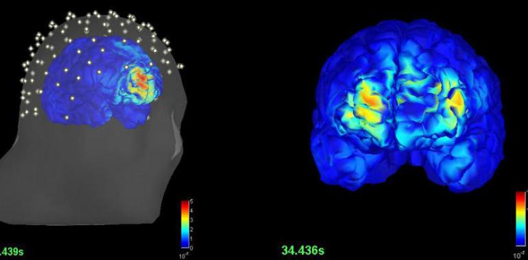 Nuevo modo de detectar epilepsia sin intervención quirúrgica