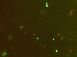 CSIC y UniOvi demuestran que bacterias beneficiosas mejoran el lupus