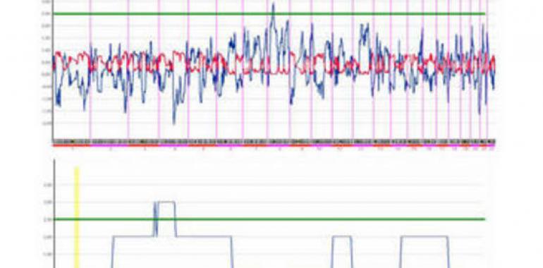 Más cerca de hallar las causas  de la diabetes monogénica