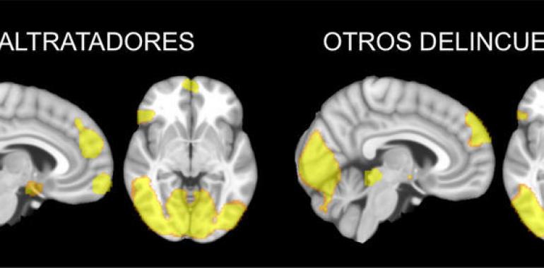 Los cerebros de los maltratadores son diferentes a los de otros delincuentes
