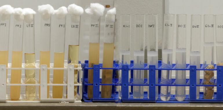Un estudio del CSIC identifica las enzimas responsables de la resistencia a antibióticos