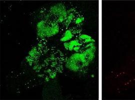 Regiones del ADN que regulan la expresión génica del sistema nervioso tienen actividad en otros tejidos