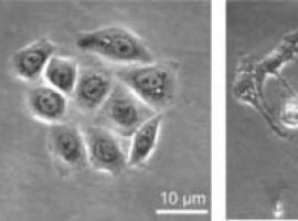 Cortactin: oncoproteína clave para entender la infección por Helicobacter pylori