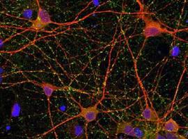 Un estudio del CSIC identifica una molécula para el potencial tratamiento del ictus